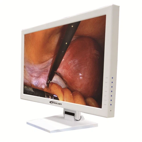 19 Palcový farebný endoskop